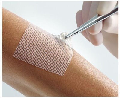 L+R Lomatuell Pro gel forming contact net