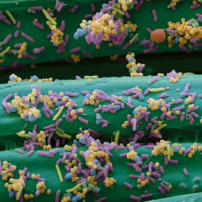 BSN medical Cutimed Sorbact Tamponaden