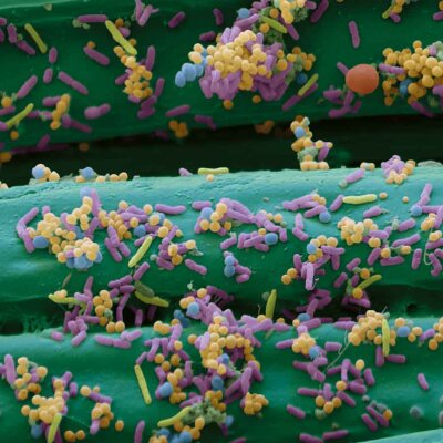 BSN medical Cutimed Sorbion Sorbact